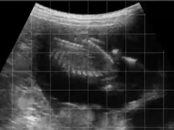 {{brizy_dc_image_alt entityId=